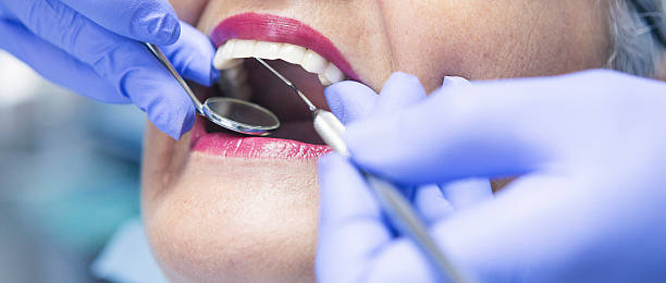 Best Emergency Dental Care for Sports Injuries in Decorah, IA